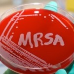 mrsa funding